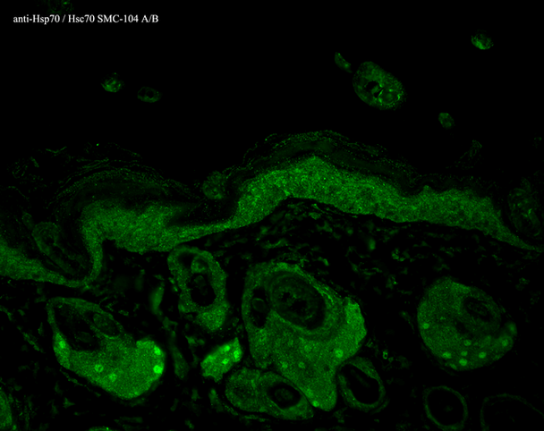 Immunohistochemistry analysis using Mouse Anti-Hsp70 Monoclonal Antibody, Clone N27F3-4 (STMA00002). Tissue: backskin. Species: Mouse. Fixation: Bouin's Fixative and paraffin-embedded. Primary Antibody: Mouse Anti-Hsp70 Monoclonal Antibody (STMA00002) at 1:100 for 1 hour at RT. Secondary Antibody: FITC Goat Anti-Mouse (green) at 1:50 for 1 hour at RT. Localization: Epidermis.