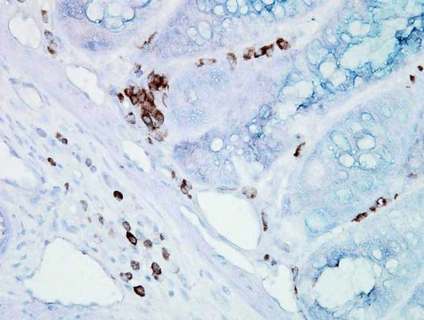 Immunohistochemistry analysis using Mouse Anti-Hsp70 Monoclonal Antibody, Clone BB70 (STMA00004). Tissue: inflamed colon. Species: Mouse. Fixation: Formalin. Primary Antibody: Mouse Anti-Hsp70 Monoclonal Antibody (STMA00004) at 1:10000 for 12 hours at 4°C. Secondary Antibody: Biotin Goat Anti-Mouse at 1:2000 for 1 hour at RT. Counterstain: Mayer Hematoxylin (purple/blue) nuclear stain at 200 µl for 2 minutes at RT.
