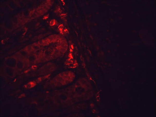 Immunohistochemistry analysis using Mouse Anti-Hsp90 Monoclonal Antibody, Clone H9010 (STMA00005). Tissue: inflamed colon. Species: Mouse. Fixation: Formalin. Primary Antibody: Mouse Anti-Hsp90 Monoclonal Antibody (STMA00005) at 1:10000 for 12 hours at 4°C. Secondary Antibody: Alexa Fluor 555 Goat Anti-Mouse (red) at 1:5000 for 1 hour at RT. Localization: Inflammatory and epithelial mucosa. Magnification: 40x. Inflammatory and epithelial mucosa.