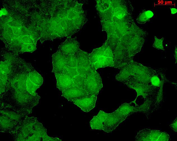 Immunocytochemistry/Immunofluorescence analysis using Mouse Anti-PSD95 Monoclonal Antibody, Clone 6G6 (STMA00013). Tissue: HaCaT cells. Species: Human. Fixation: Cold 100% methanol for 10 minutes at -20°C. Primary Antibody: Mouse Anti-PSD95 Monoclonal Antibody (STMA00013) at 1:100 for 1 hour at RT. Secondary Antibody: FITC Goat Anti-Mouse (green) at 1:50 for 1 hour at RT. Localization: Junction staining.