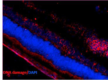 Immunohistochemistry analysis using Mouse Anti-DNA Damage Monoclonal Antibody, Clone 15A3 (STMA00034). Tissue: Retinal Injury Model. Species: Mouse. Primary Antibody: Mouse Anti-DNA Damage Monoclonal Antibody (STMA00034) at 1:1000. Secondary Antibody: Alexa Fluor 594 Goat Anti-Mouse (red). Courtesy of: Dr. Rajashekhar Gangaraju, University of Indiana, Department of Ophthalmology, Eugene and Marilyn Glick Eye Institute.