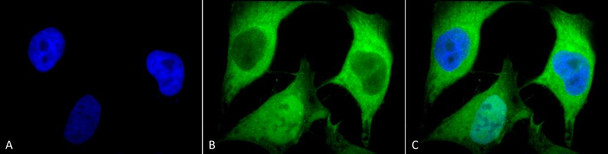 Immunocytochemistry/Immunofluorescence analysis using Mouse Anti-Ubiquitin Monoclonal Antibody, Clone 5B9-B3 (STMA00036). Tissue: Cervical cancer cell line (HeLa). Species: Human. Fixation: 2% Formaldehyde for 20 min at RT. Primary Antibody: Mouse Anti-Ubiquitin Monoclonal Antibody (STMA00036) at 1:100 for 12 hours at 4°C. Secondary Antibody: FITC Goat Anti-Mouse (green) at 1:200 for 2 hours at RT.