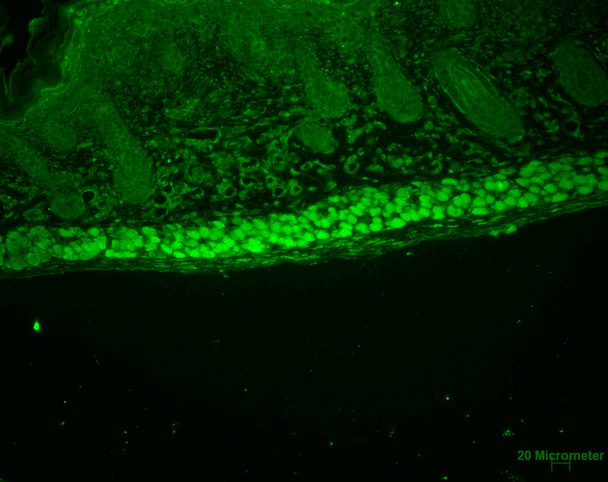 Immunohistochemistry analysis using Rat Anti-Aha1 Monoclonal Antibody, Clone 25F2.D9 (STMA00044). Tissue: backskin. Species: Mouse. Fixation: Bouin's Fixative and paraffin-embedded. Primary Antibody: Rat Anti-Aha1 Monoclonal Antibody (STMA00044) at 1:100 for 1 hour at RT. Secondary Antibody: FITC Goat Anti-Rat (green) at 1:50 for 1 hour at RT. Localization: Uppermost epidermis staining, and muscle.