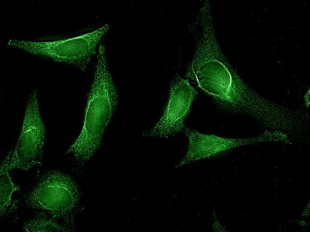 Immunocytochemistry/Immunofluorescence analysis using Rat Anti-Aha1 Monoclonal Antibody, Clone 25F2.D10 (STMA00045). Tissue: Cervical cancer cell line (HeLa). Species: Human. Primary Antibody: Rat Anti-Aha1 Monoclonal Antibody (STMA00045) at 1:1000. Secondary Antibody: FITC Goat Anti-Rat (green).