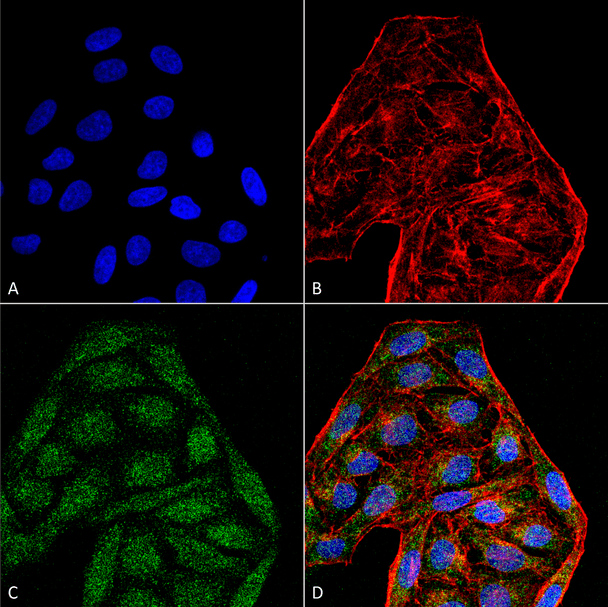 Immunocytochemistry/Immunofluorescence analysis using Mouse Anti-CD74 Monoclonal Antibody, Clone 6D9 (STMA00079). Tissue: Cervical cancer cell line (HeLa). Species: Human. Fixation: 4% Formaldehyde for 15 min at RT. Primary Antibody: Mouse Anti-CD74 Monoclonal Antibody (STMA00079) at 1:100 for 60 min at RT. Secondary Antibody: Goat Anti-Mouse ATTO 488 at 1:200 for 60 min at RT.