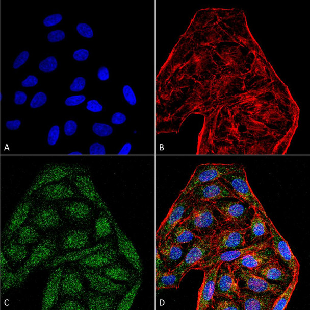 Immunocytochemistry/Immunofluorescence analysis using Mouse Anti-CD74 Monoclonal Antibody, Clone 6D9 (STMA00079). Tissue: Cervical cancer cell line (HeLa). Species: Human. Fixation: 4% Formaldehyde for 15 min at RT. Primary Antibody: Mouse Anti-CD74 Monoclonal Antibody (STMA00079) at 1:100 for 60 min at RT. Secondary Antibody: Goat Anti-Mouse ATTO 488 at 1:200 for 60 min at RT.