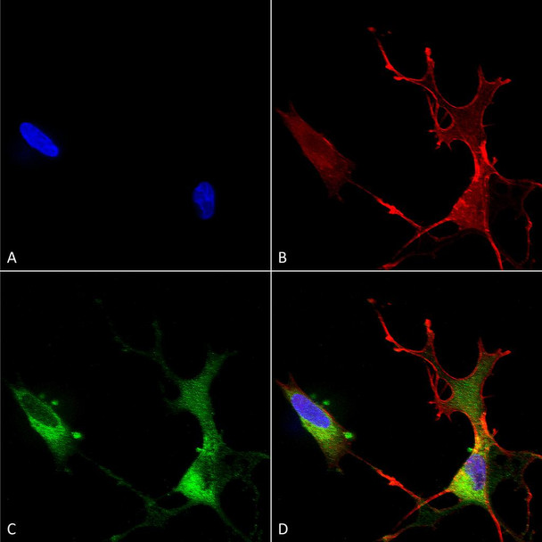 Immunocytochemistry/Immunofluorescence analysis using Mouse Anti-Cav1.2 Monoclonal Antibody, Clone S57 (STMA00080). Tissue: Neuroblastoma cells (SH-SY5Y). Species: Human. Fixation: 4% PFA for 15 min. Primary Antibody: Mouse Anti-Cav1.2 Monoclonal Antibody (STMA00080) at 1:50 for overnight at 4°C with slow rocking. Secondary Antibody: AlexaFluor 488 at 1:1000 for 1 hour at RT.