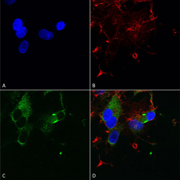 Immunocytochemistry/Immunofluorescence analysis using Mouse Anti-Cav1.3 Monoclonal Antibody, Clone S48 (STMA00081). Tissue: Neuroblastoma cells (SH-SY5Y). Species: Human. Fixation: 4% PFA for 15 min. Primary Antibody: Mouse Anti-Cav1.3 Monoclonal Antibody (STMA00081) at 1:50 for overnight at 4°C with slow rocking. Secondary Antibody: AlexaFluor 488 at 1:1000 for 1 hour at RT.
