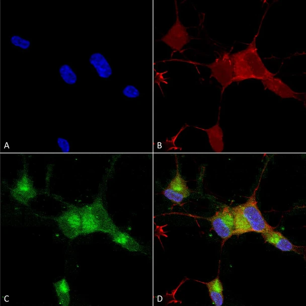 Immunocytochemistry/Immunofluorescence analysis using Mouse Anti-Nav1.7 Monoclonal Antibody, Clone N68/6 (STMA00088). Tissue: Neuroblastoma cells (SH-SY5Y). Species: Human. Fixation: 4% PFA for 15 min. Primary Antibody: Mouse Anti-Nav1.7 Monoclonal Antibody (STMA00088) at 1:100 for overnight at 4°C with slow rocking. Secondary Antibody: AlexaFluor 488 at 1:1000 for 1 hour at RT.