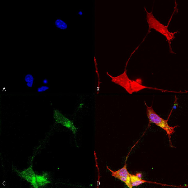 Immunocytochemistry/Immunofluorescence analysis using Mouse Anti-SHANK (pan) Monoclonal Antibody, Clone S23b-49 (STMA00093). Tissue: Neuroblastoma cells (SH-SY5Y). Species: Human. Fixation: 4% PFA for 15 min. Primary Antibody: Mouse Anti-SHANK (pan) Monoclonal Antibody (STMA00093) at 1:50 for overnight at 4°C with slow rocking. Secondary Antibody: AlexaFluor 488 at 1:1000 for 1 hour at RT.