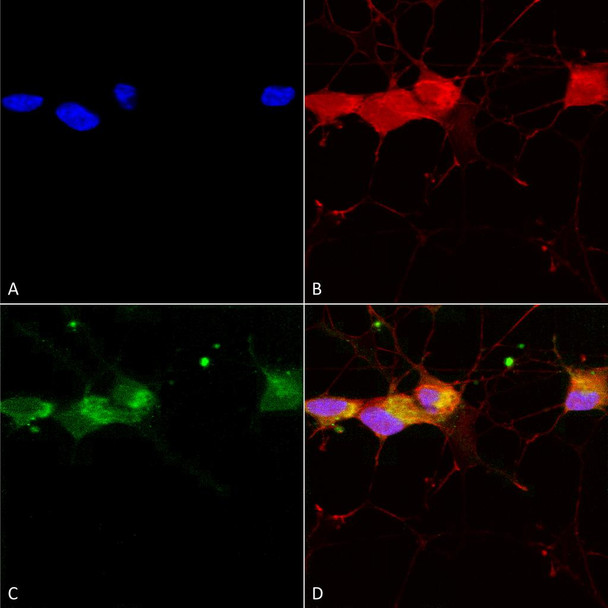 Immunocytochemistry/Immunofluorescence analysis using Mouse Anti-GluN2B Monoclonal Antibody, Clone S59-36 (STMA00098). Tissue: Neuroblastoma cells (SH-SY5Y). Species: Human. Fixation: 4% PFA for 15 min. Primary Antibody: Mouse Anti-GluN2B Monoclonal Antibody (STMA00098) at 1:50 for overnight at 4°C with slow rocking. Secondary Antibody: AlexaFluor 488 at 1:1000 for 1 hour at RT.