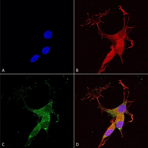 Immunocytochemistry/Immunofluorescence analysis using Mouse Anti-VGLUT3 Monoclonal Antibody, Clone N34/34 (STMA00112). Tissue: Neuroblastoma cells (SH-SY5Y). Species: Human. Fixation: 4% PFA for 15 min. Primary Antibody: Mouse Anti-VGLUT3 Monoclonal Antibody (STMA00112) at 1:50 for overnight at 4°C with slow rocking. Secondary Antibody: AlexaFluor 488 at 1:1000 for 1 hour at RT.