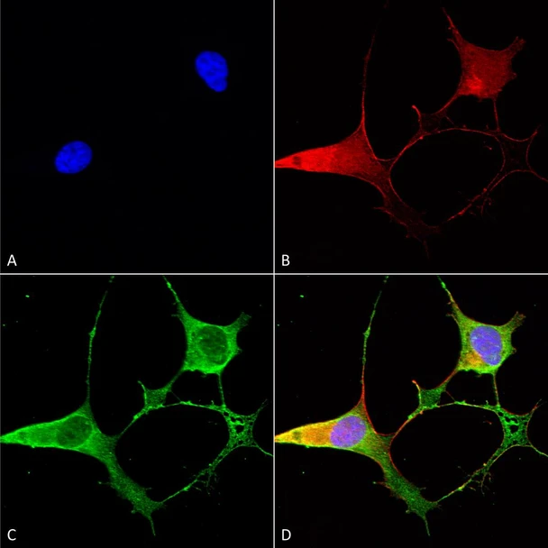Immunocytochemistry/Immunofluorescence analysis using Mouse Anti-Ankyrin B Monoclonal Antibody, Clone N105/13 (STMA00115). Tissue: Neuroblastoma cells (SH-SY5Y). Species: Human. Fixation: 4% PFA for 15 min. Primary Antibody: Mouse Anti-Ankyrin B Monoclonal Antibody (STMA00115) at 1:50 for overnight at 4°C with slow rocking. Secondary Antibody: AlexaFluor 488 at 1:1000 for 1 hour at RT.