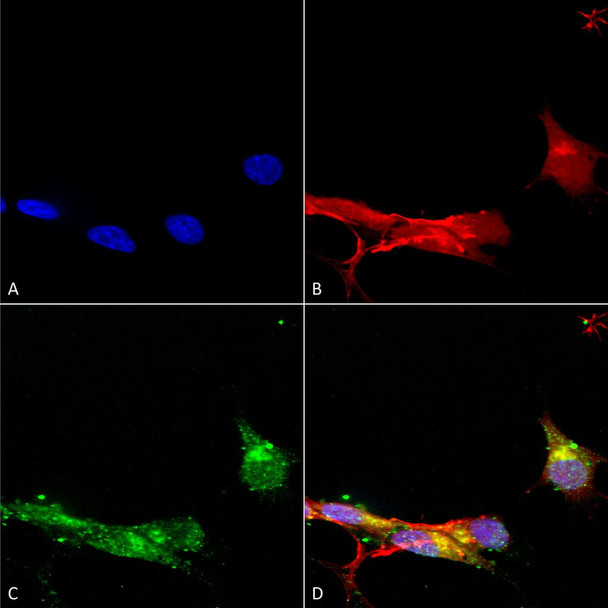 Immunocytochemistry/Immunofluorescence analysis using Mouse Anti-mGluR1/5 Monoclonal Antibody, Clone N75/33 (STMA00121). Tissue: Neuroblastoma cells (SH-SY5Y). Species: Human. Fixation: 4% PFA for 15 min. Primary Antibody: Mouse Anti-mGluR1/5 Monoclonal Antibody (STMA00121) at 1:100 for overnight at 4°C with slow rocking. Secondary Antibody: AlexaFluor 488 at 1:1000 for 1 hour at RT.