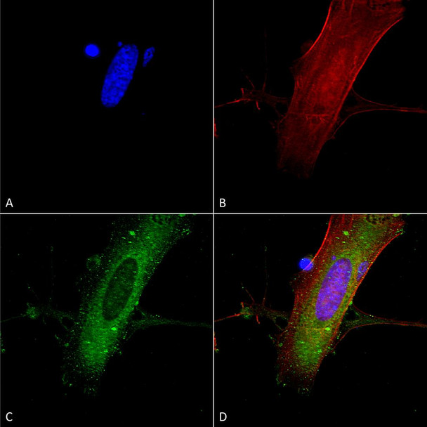 Immunocytochemistry/Immunofluorescence analysis using Mouse Anti-GluN2A Monoclonal Antibody, Clone N327A/38 (STMA00137). Tissue: Neuroblastoma cells (SH-SY5Y). Species: Human. Fixation: 4% PFA for 15 min. Primary Antibody: Mouse Anti-GluN2A Monoclonal Antibody (STMA00137) at 1:100 for overnight at 4°C with slow rocking. Secondary Antibody: AlexaFluor 488 at 1:1000 for 1 hour at RT.