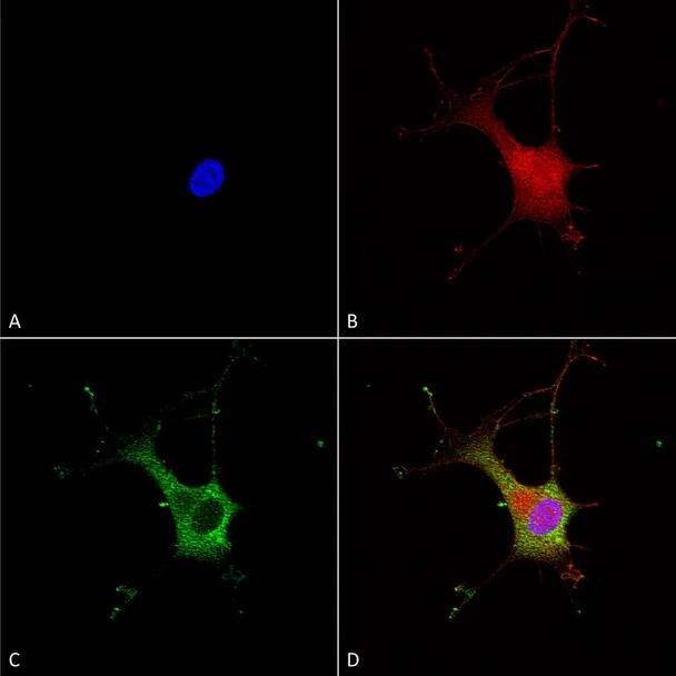 Immunocytochemistry/Immunofluorescence analysis using Mouse Anti-Alpha-2C Adrenergic Receptor Monoclonal Antibody, Clone N330A/80 (STMA00138). Tissue: Neuroblastoma cells (SH-SY5Y). Species: Human. Fixation: 4% PFA for 15 min. Primary Antibody: Mouse Anti-Alpha-2C Adrenergic Receptor Monoclonal Antibody (STMA00138) at 1:100 for overnight at 4°C with slow rocking. Secondary Antibody: AlexaFluor 488 at 1:1000 for 1 hour at RT.