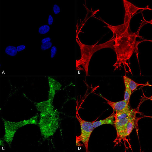 Immunocytochemistry/Immunofluorescence analysis using Mouse Anti-GFAP Monoclonal Antibody, Clone N206A/8 (STMA00141). Tissue: Neuroblastoma cells (SH-SY5Y). Species: Human. Fixation: 4% PFA for 15 min. Primary Antibody: Mouse Anti-GFAP Monoclonal Antibody (STMA00141) at 1:50 for overnight at 4°C with slow rocking. Secondary Antibody: AlexaFluor 488 at 1:1000 for 1 hour at RT.