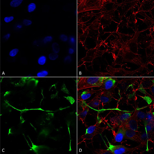 Immunocytochemistry/Immunofluorescence analysis using Mouse Anti-ATF4 Monoclonal Antibody, Clone N360A/24 (STMA00146). Tissue: Neuroblastoma cells (SH-SY5Y). Species: Human. Fixation: 4% PFA for 15 min. Primary Antibody: Mouse Anti-ATF4 Monoclonal Antibody (STMA00146) at 1:200 for overnight at 4°C with slow rocking. Secondary Antibody: AlexaFluor 488 at 1:1000 for 1 hour at RT.