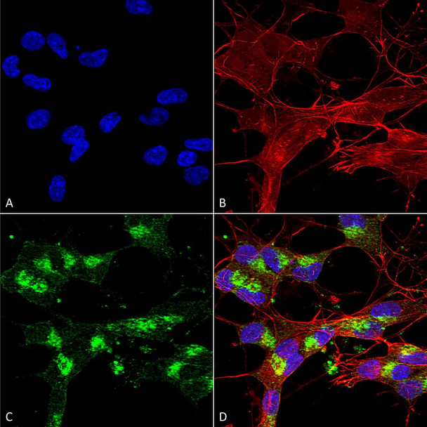 Immunocytochemistry/Immunofluorescence analysis using Mouse Anti-VDAC1 Monoclonal Antibody, Clone N152B/23 (STMA00151). Tissue: Neuroblastoma cells (SH-SY5Y). Species: Human. Fixation: 4% PFA for 15 min. Primary Antibody: Mouse Anti-VDAC1 Monoclonal Antibody (STMA00151) at 1:100 for overnight at 4°C with slow rocking. Secondary Antibody: AlexaFluor 488 at 1:1000 for 1 hour at RT.