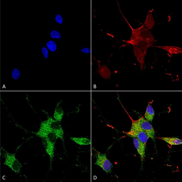 Immunocytochemistry/Immunofluorescence analysis using Mouse Anti-SHANK1/SHANK3 Monoclonal Antibody, Clone N367/51 (STMA00153). Tissue: Neuroblastoma cells (SH-SY5Y). Species: Human. Fixation: 4% PFA for 15 min. Primary Antibody: Mouse Anti-SHANK1/SHANK3 Monoclonal Antibody (STMA00153) at 1:100 for overnight at 4°C with slow rocking. Secondary Antibody: AlexaFluor 488 at 1:1000 for 1 hour at RT.