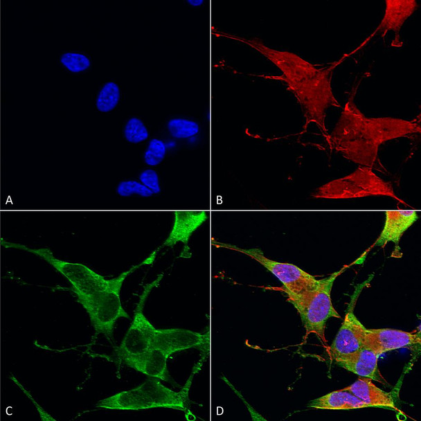 Immunocytochemistry/Immunofluorescence analysis using Mouse Anti-Ankyrin R Monoclonal Antibody, Clone N388A/10 (STMA00167). Tissue: Neuroblastoma cells (SH-SY5Y). Species: Human. Fixation: 4% PFA for 15 min. Primary Antibody: Mouse Anti-Ankyrin R Monoclonal Antibody (STMA00167) at 1:100 for overnight at 4°C with slow rocking. Secondary Antibody: AlexaFluor 488 at 1:1000 for 1 hour at RT.
