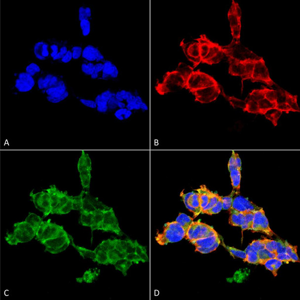 Immunocytochemistry/Immunofluorescence analysis using Mouse Anti-O-GalNAC Monoclonal Antibody, Clone 9B9 (STMA00176). Tissue: Embryonic kidney epithelial cell line (HEK293). Species: Human. Fixation: 5% Formaldehyde for 5 min. Primary Antibody: Mouse Anti-O-GalNAC Monoclonal Antibody (STMA00176) at 1:50 for 30-60 min at RT. Secondary Antibody: Goat Anti-Mouse Alexa Fluor 488 at 1:1500 for 30-60 min at RT.
