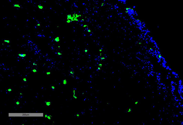 Immunohistochemistry analysis using Mouse Anti-Acrolein Monoclonal Antibody, Clone 10A10 (STMA00178). Tissue: Adrenal Carcinoma. Species: Human. Primary Antibody: Mouse Anti-Acrolein Monoclonal Antibody (STMA00178) at 1:100 for Overnight at 4C, then 30 min at 37C. Secondary Antibody: Goat Anti-Mouse IgG (H+L): FITC for 45 min at 37C. Counterstain: DAPI for 3 min at RT. Magnification: 5X.