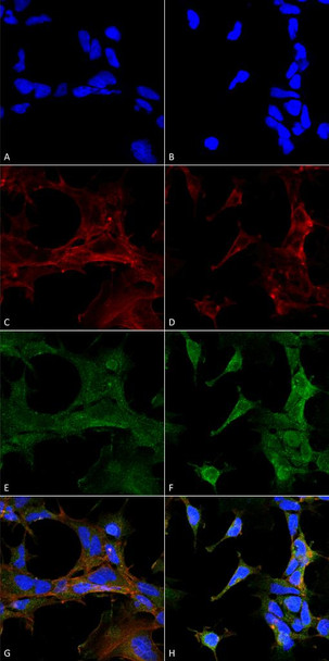 Immunocytochemistry/Immunofluorescence analysis using Mouse Anti-4-Hydroxy-2-hexenal Monoclonal Antibody, Clone 6F10 (STMA00181). Tissue: Embryonic kidney epithelial cell line (HEK293). Species: Human. Fixation: 5% Formaldehyde for 5 min. Primary Antibody: Mouse Anti-4-Hydroxy-2-hexenal Monoclonal Antibody (STMA00181) at 1:400 for 30-60 min at RT. Secondary Antibody: Goat Anti-Mouse Alexa Fluor 488 at 1:1500 for 30-60 min at RT.