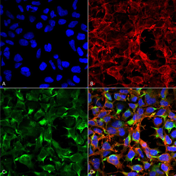 Immunocytochemistry/Immunofluorescence analysis using Mouse Anti-Dityrosine Monoclonal Antibody, Clone 7D4 (STMA00188). Tissue: Embryonic kidney cells (HEK293) cultured overnight with 50 µM H2O2. Species: Human. Fixation: 5% Formaldehyde for 5 min. Primary Antibody: Mouse Anti-Dityrosine Monoclonal Antibody (STMA00188) at 1:50 for 30-60 min at RT. Secondary Antibody: Goat Anti-Mouse Alexa Fluor 488 at 1:1500 for 30-60 min at RT.