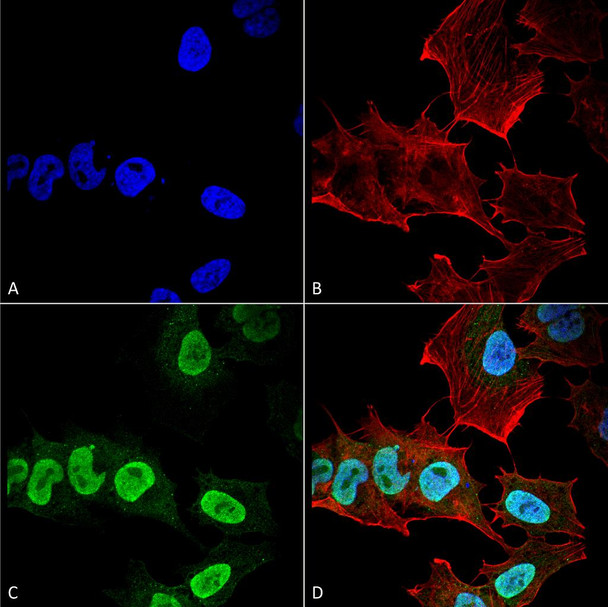 Immunocytochemistry/Immunofluorescence analysis using Mouse Anti-Alpha Synuclein Monoclonal Antibody, Clone 10H7 (STMA00192). Tissue: Neuroblastoma cell line (SK-N-BE). Species: Human. Fixation: 4% Formaldehyde for 15 min at RT. Primary Antibody: Mouse Anti-Alpha Synuclein Monoclonal Antibody (STMA00192) at 1:100 for 60 min at RT. Secondary Antibody: Goat Anti-Mouse ATTO 488 at 1:200 for 60 min at RT.