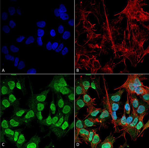 Immunocytochemistry/Immunofluorescence analysis using Mouse Anti-Alpha Synuclein Monoclonal Antibody, Clone 3F8 (STMA00193). Tissue: Neuroblastoma cell line (SK-N-BE). Species: Human. Fixation: 4% Formaldehyde for 15 min at RT. Primary Antibody: Mouse Anti-Alpha Synuclein Monoclonal Antibody (STMA00193) at 1:100 for 60 min at RT. Secondary Antibody: Goat Anti-Mouse ATTO 488 at 1:200 for 60 min at RT.