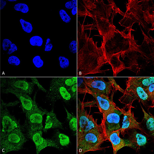 Immunocytochemistry/Immunofluorescence analysis using Mouse Anti-Alpha Synuclein Monoclonal Antibody, Clone 4F1 (STMA00194). Tissue: Neuroblastoma cell line (SK-N-BE). Species: Human. Fixation: 4% Formaldehyde for 15 min at RT. Primary Antibody: Mouse Anti-Alpha Synuclein Monoclonal Antibody (STMA00194) at 1:100 for 60 min at RT. Secondary Antibody: Goat Anti-Mouse ATTO 488 at 1:200 for 60 min at RT.