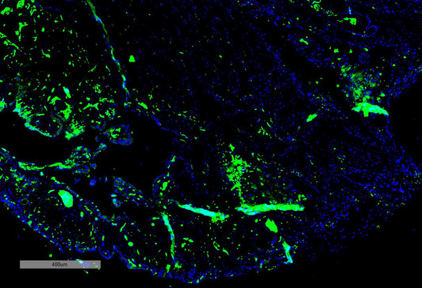 Immunohistochemistry analysis using Mouse Anti-Parvalbumin Monoclonal Antibody, Clone C12 (STMA00205). Tissue: Thyroid Cancer. Species: Human. Primary Antibody: Mouse Anti-Parvalbumin Monoclonal Antibody (STMA00205) at 1:100 for Overnight at 4C, then 30 min at 37C. Secondary Antibody: Goat Anti-Mouse IgG (H+L): FITC for 45 min at 37C. Counterstain: DAPI for 3 min at RT. Magnification: 5X.