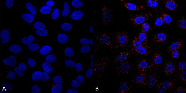 Immunocytochemistry/Immunofluorescence analysis using Mouse Anti-VPS35 Monoclonal Antibody, Clone 5A9 (STMA00209). Tissue: A549 cells. Species: Human. Primary Antibody: Mouse Anti-VPS35 Monoclonal Antibody (STMA00209) at 1:5 (tissue culture supernatant). Secondary Antibody: Donkey anti-mouse: Alexa Fluor 594 at 1:4000 in 0.2% BSA PBS. Counterstain: DAPI. Localization: Vesicles. A) VPS35 KO A549 cells B) WT A549 cells.