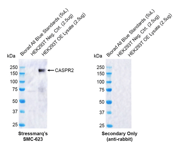 Western blot analysis with Rabbit Anti-CASPR2 Monoclonal Antibody, Clone FF19 (STMA00227) showing detection of Human CASPR2 protein in a transient over-expression (OE) lysate (OriGene LY402278). Block: 2% skim milk + 2% BSA for 1 hour at RT. Primary Antibody: Rabbit Anti-Human CASPR2 Recombinant Monoclonal [FF19] (STMA00227) at 1:1000 for 2 hours at RT. Secondary Antibody: Goat anti-rabbit IgG-HRP (H&L) at 1:5000 for 1 hour at RT.