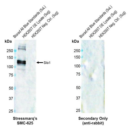 Western blot analysis with Rabbit Anti- Slo1 Monoclonal Antibody, Clone S22 (STMA00229) showing detection of Human Slo1 protein in a transient over-expression (OE) lysate (OriGene LY400815). Block: 2% skim milk + 2% BSA for 1 hour at RT. Primary Antibody: Rabbit Anti-Mouse Slo1 Recombinant Monoclonal [S22] (STMA00229) at 1:1000 for 2 hours at RT. Secondary Antibody: at 1:5000 for 1 hour at RT.