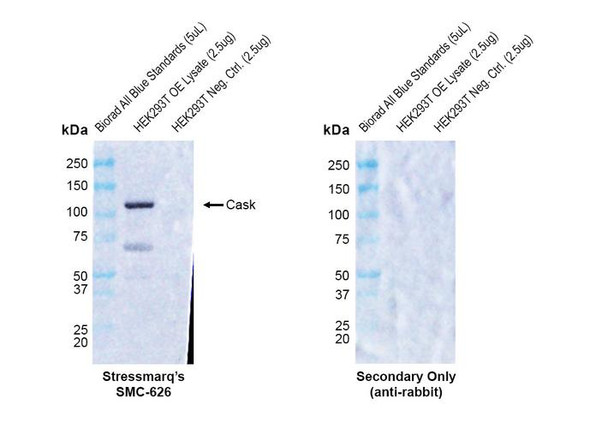 Western blot analysis with Rabbit Anti-CASK Monoclonal Antibody, Clone PT55 (STMA00230) showing detection of Human CASK protein in a transient over-expression (OE) lysate (OriGene LY401218). Block: 2% skim milk + 2% BSA for 1 hour at RT. Primary Antibody: Rabbit Anti-Human CASK Recombinant Monoclonal [PT55] (STMA00230) at 1:10,000 for 2 hours at RT. Secondary Antibody: Goat anti-rabbit IgG-HRP (H&L) at 1:5000 for 1 hour at RT.