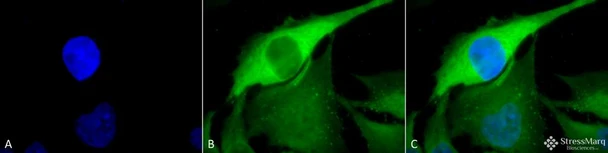 Immunocytochemistry/Immunofluorescence analysis using Rabbit Anti-Hsp70 Polyclonal Antibody (STPA00002). Tissue: Heat Shocked Cervical cancer cell line (HeLa). Species: Human. Fixation: 2% Formaldehyde for 20 min at RT. Primary Antibody: Rabbit Anti-Hsp70 Polyclonal Antibody (STPA00002) at 1:100 for 12 hours at 4°C. Secondary Antibody: FITC Goat Anti-Rabbit (green) at 1:200 for 2 hours at RT.
