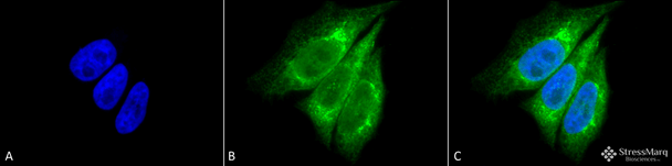 Immunocytochemistry/Immunofluorescence analysis using Rabbit Anti-KDEL Polyclonal Antibody (STPA00008). Tissue: Heat Shocked Cervical cancer cell line (HeLa). Species: Human. Fixation: 2% Formaldehyde for 20 min at RT. Primary Antibody: Rabbit Anti-KDEL Polyclonal Antibody (STPA00008) at 1:100 for 12 hours at 4°C. Secondary Antibody: FITC Goat Anti-Rabbit (green) at 1:200 for 2 hours at RT.