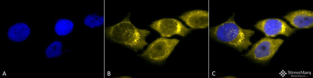 Immunocytochemistry/Immunofluorescence analysis using Rabbit Anti-SOD2 (Mn) Polyclonal Antibody (STPA00013). Tissue: Cervical cancer cell line (HeLa). Species: Human. Fixation: 2% Formaldehyde for 20 min at RT. Primary Antibody: Rabbit Anti-SOD2 (Mn) Polyclonal Antibody (STPA00013) at 1:120 for 12 hours at 4°C. Secondary Antibody: R-PE Goat Anti-Rabbit (yellow) at 1:200 for 2 hours at RT.