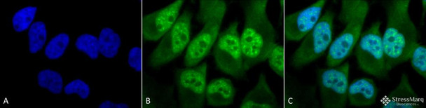 Immunocytochemistry/Immunofluorescence analysis using Rabbit Anti-Phosphothreonine Polyclonal Antibody (STPA00022). Tissue: Cervical cancer cell line (HeLa). Species: Human. Fixation: 2% Formaldehyde for 20 min at RT. Primary Antibody: Rabbit Anti-Phosphothreonine Polyclonal Antibody (STPA00022) at 1:60 for 12 hours at 4°C. Secondary Antibody: FITC Goat Anti-Rabbit (green) at 1:200 for 2 hours at RT.