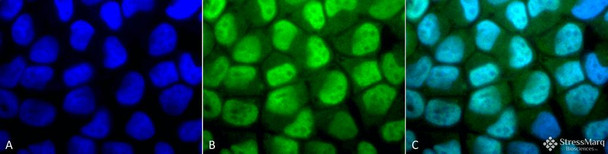 Immunocytochemistry/Immunofluorescence analysis using Rabbit Anti-Methylated Lysine Polyclonal Antibody (STPA00024). Tissue: Cervical cancer cell line (HeLa). Species: Human. Fixation: 2% Formaldehyde for 20 min at RT. Primary Antibody: Rabbit Anti-Methylated Lysine Polyclonal Antibody (STPA00024) at 1:50 for 12 hours at 4°C. Secondary Antibody: FITC Goat Anti-Rabbit (green) at 1:200 for 2 hours at RT.