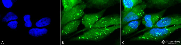 Immunocytochemistry/Immunofluorescence analysis using Rabbit Anti-p38 Polyclonal Antibody (STPA00027). Tissue: Cervical cancer cell line (HeLa). Species: Human. Fixation: 2% Formaldehyde for 20 min at RT. Primary Antibody: Rabbit Anti-p38 Polyclonal Antibody (STPA00027) at 1:100 for 12 hours at 4°C. Secondary Antibody: FITC Goat Anti-Rabbit (green) at 1:200 for 2 hours at RT. Counterstain: DAPI (blue) nuclear stain at 1:40000 for 2 hours at RT.