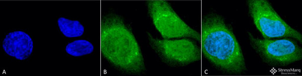 Immunocytochemistry/Immunofluorescence analysis using Rabbit Anti-GRP78 (Bip) Polyclonal Antibody (STPA00029). Tissue: Heat Shocked Cervical cancer cell line (HeLa). Species: Human. Fixation: 2% Formaldehyde for 20 min at RT. Primary Antibody: Rabbit Anti-GRP78 (Bip) Polyclonal Antibody (STPA00029) at 1:100 for 12 hours at 4°C. Secondary Antibody: FITC Goat Anti-Rabbit (green) at 1:200 for 2 hours at RT.
