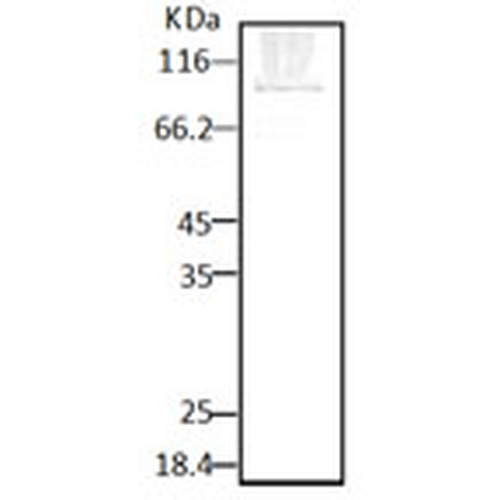 Western blot analysis of Parasite Lysates showing detection of HSP90 protein using Rabbit Anti-HSP90 Polyclonal Antibody (STPA00035). Primary Antibody: Rabbit Anti-HSP90 Polyclonal Antibody (STPA00035) at 1:2000.