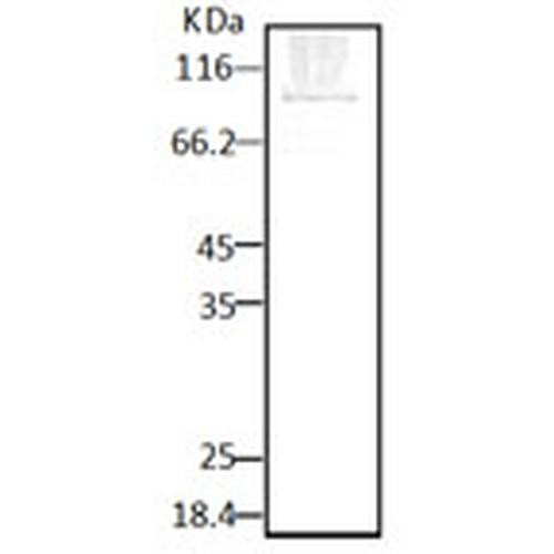 Western blot analysis of Parasite Lysates showing detection of HSP90 protein using Rabbit Anti-HSP90 Polyclonal Antibody (STPA00035). Primary Antibody: Rabbit Anti-HSP90 Polyclonal Antibody (STPA00035) at 1:2000.