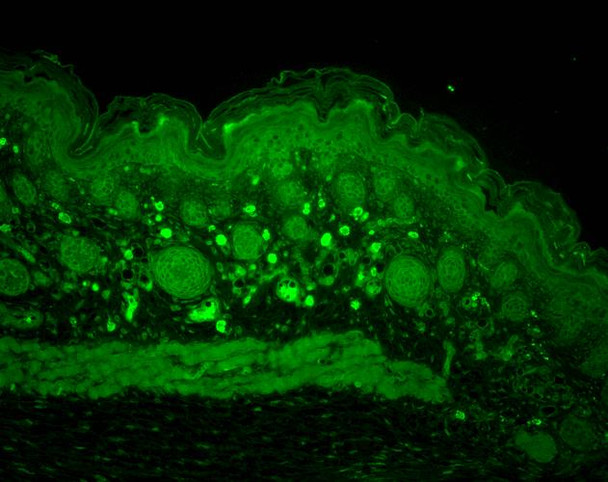 Immunohistochemistry analysis using Rabbit Anti-HSP110 Polyclonal Antibody (STPA00037). Tissue: backskin. Species: Mouse. Fixation: Bouin's Fixative Solution. Primary Antibody: Rabbit Anti-HSP110 Polyclonal Antibody (STPA00037) at 1:100 for 1 hour at RT. Secondary Antibody: FITC Goat Anti-Rabbit (green) at 1:50 for 1 hour at RT. Localization: Positive epidermal, dermal and muscle staining.