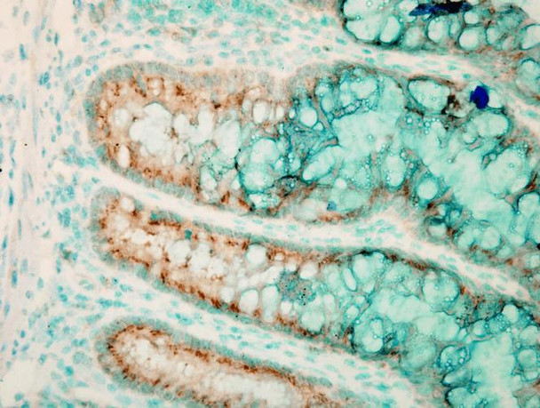 Immunohistochemistry analysis using Rabbit Anti-TLR4 Polyclonal Antibody (STPA00040). Tissue: colon colitis. Species: Mouse. Fixation: Formalin. Primary Antibody: Rabbit Anti-TLR4 Polyclonal Antibody (STPA00040) at 1:100000 for 12 hours at 4°C. Secondary Antibody: Biotin Goat Anti-Rabbit at 1:2000 for 1 hour at RT. Counterstain: Methyl Green at 200uL for 2 min at RT. Localization: Inflammatory cells.