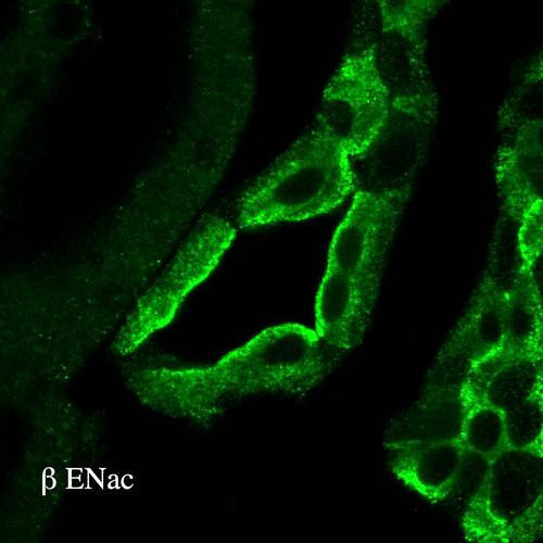 Immunohistochemistry analysis using Rabbit Anti-ENaC Polyclonal Antibody (STPA00048). Tissue: kidney tissue. Species: Rat. Primary Antibody: Rabbit Anti-ENaC Polyclonal Antibody (STPA00048) at 1:100. Secondary Antibody: FITC Goat Anti-Rabbit (green).