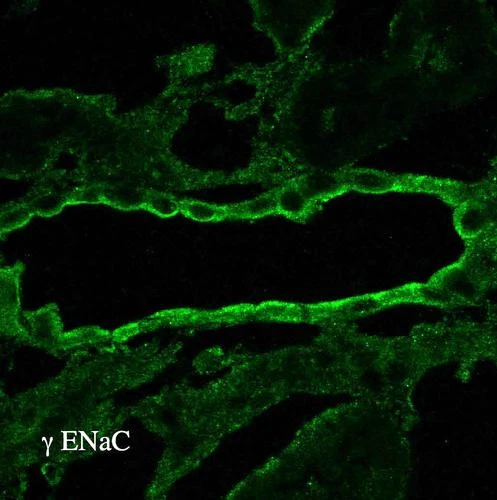 Immunohistochemistry analysis using Rabbit Anti-ENaC Polyclonal Antibody (STPA00049). Tissue: kidney tissue. Species: Rat. Primary Antibody: Rabbit Anti-ENaC Polyclonal Antibody (STPA00049) at 1:100. Secondary Antibody: FITC Goat Anti-Rabbit (green).